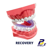 AIRWAAV RX1 RECOVERY Mouthpiece for Improved Recovery